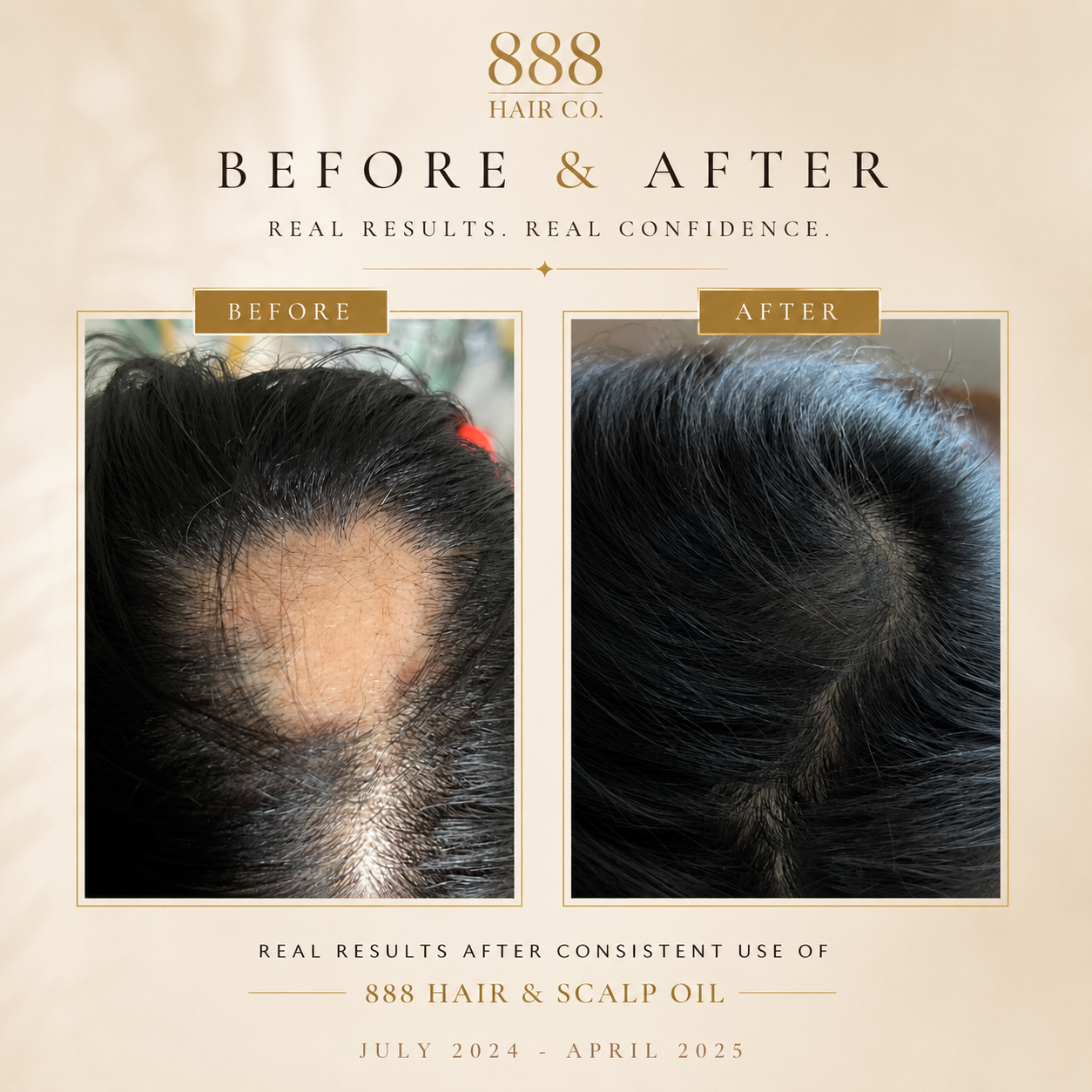 888 Hair & Scalp Oil
